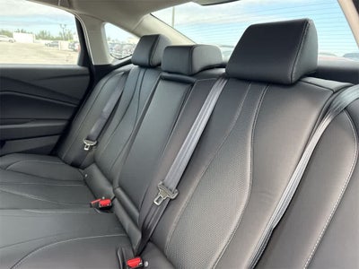 2025 Acura TLX with Technology Package