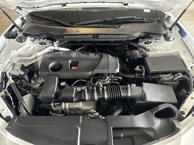 2025 Acura TLX with Technology Package