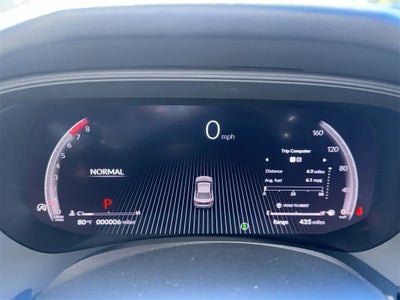 2025 Acura TLX A-Spec